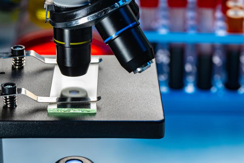 Microscope with blood samples test tubes in laboratory close up